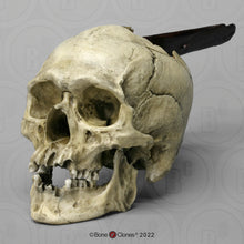 Load image into Gallery viewer, Spanish Conquistador Human Skull with Broad Ax Trauma Human skull Ax cast replica